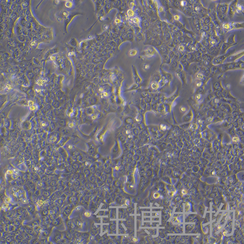 Capan-1（人胰腺癌细胞）YB-71721HC