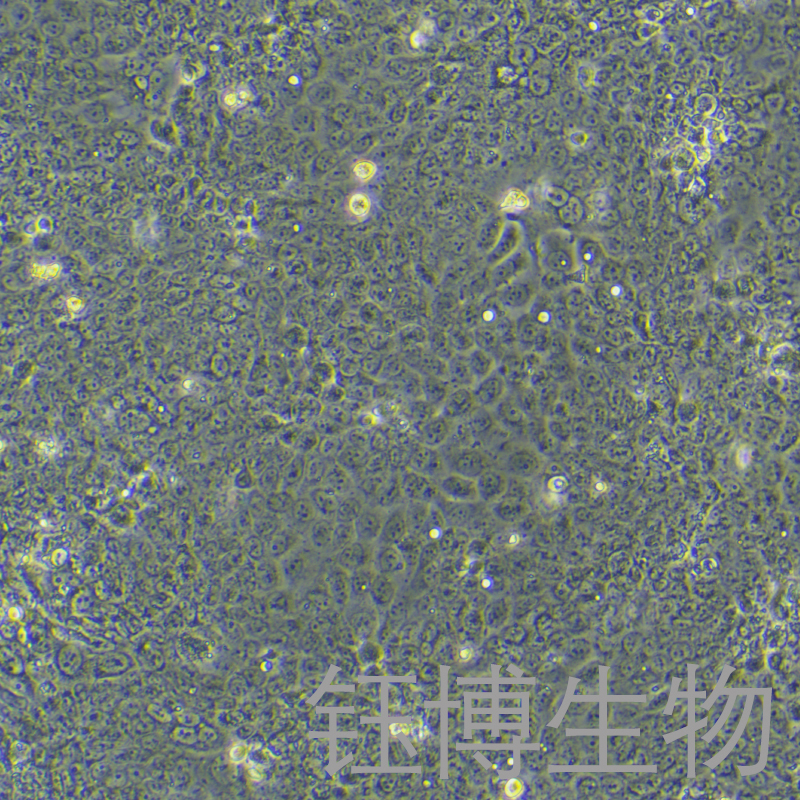 Capan-2（人胰腺癌细胞）YB-71722HC