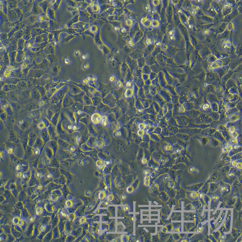 Ca9-22（人口腔上皮癌细胞）YB-71727HC