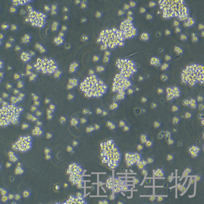 Jurkat（人急性T淋巴细胞白血病细胞）YB-71732HC