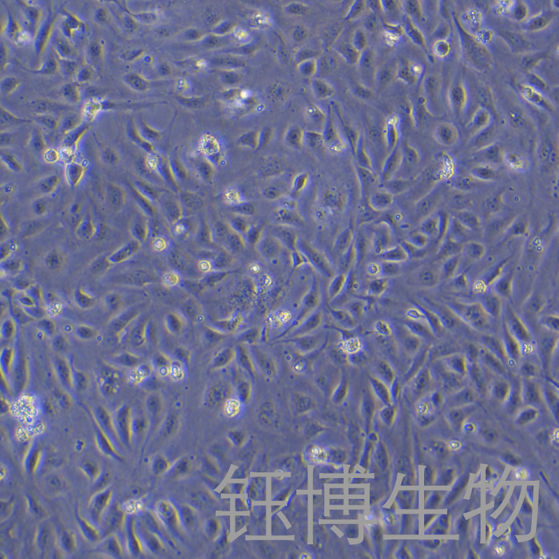 D407（人视网膜色素上皮细胞）YB-71735HC
