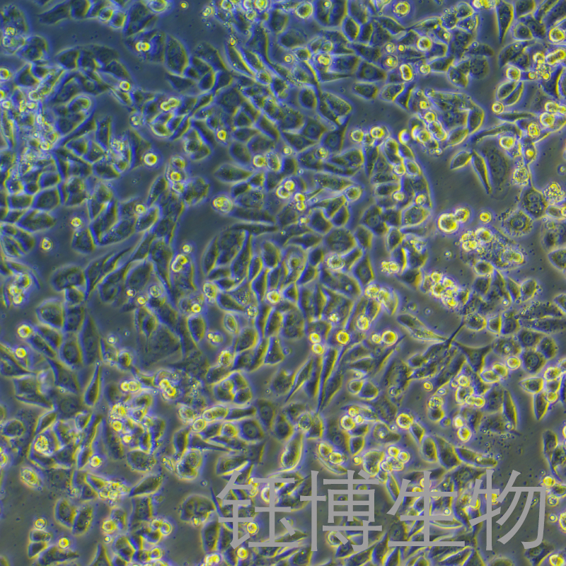 ID8（小鼠卵巢癌细胞）YB-7016MC