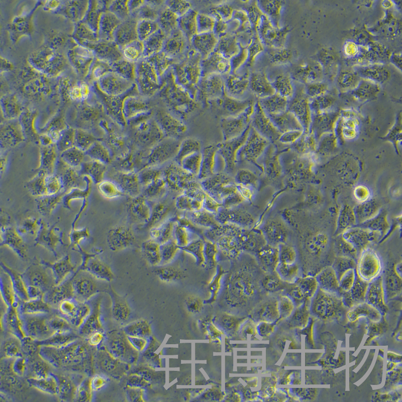 TU 686（人喉癌细胞）YB-71738HC