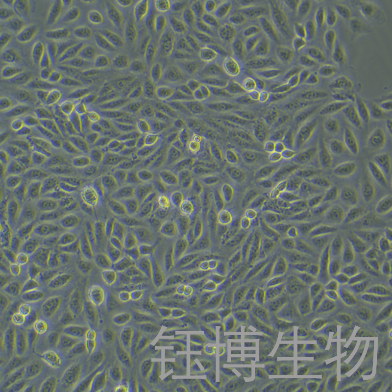 tpc-1（人甲状腺乳头状细胞）YB-71741HC