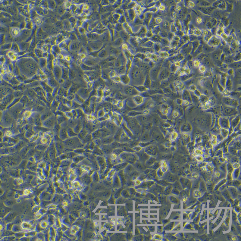 Bcpap（人甲状腺癌乳头状细胞）YB-71743HC