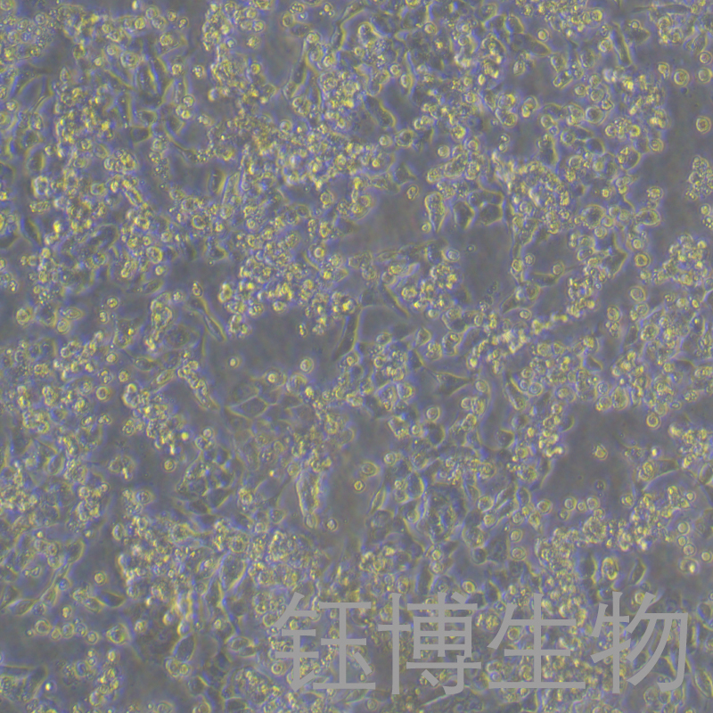 HCT116/L（人结肠癌耐奥沙利铂耐药株）YB-71746HC