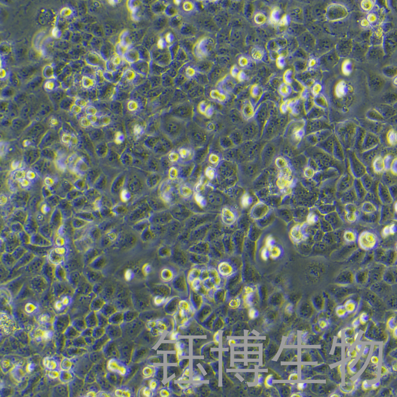 6-10b（鼻咽癌细胞株）YB-71753HC