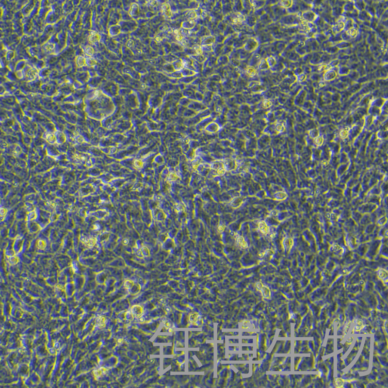 4T1-luc（小鼠乳腺癌细胞-荧光素酶标记）YB-7018MC-L