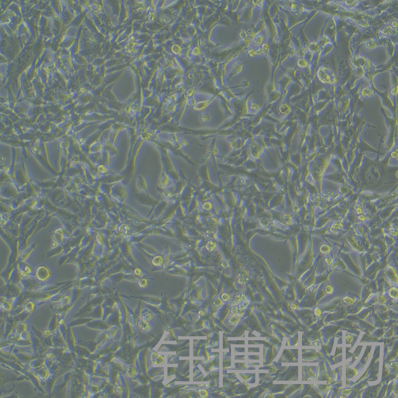 E0771（小鼠乳腺癌细胞）YB-7019MC