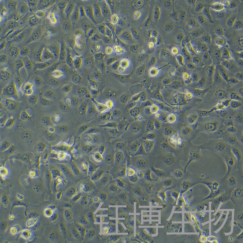 HCE-T（人角膜上皮细胞）YB-71756HC