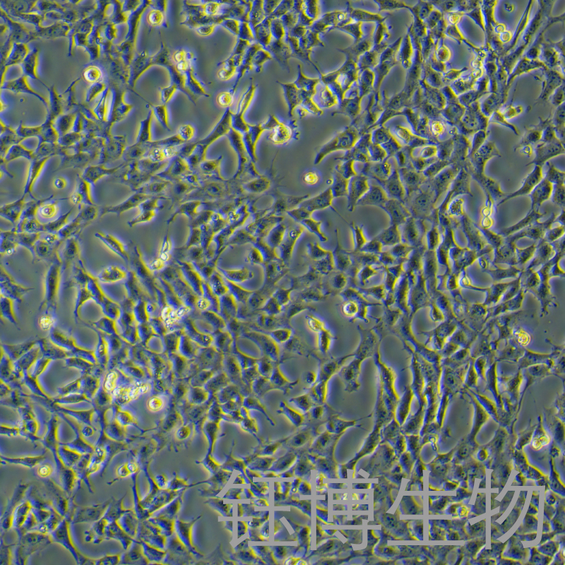 HMC（人肾小球系膜细胞）YB-71759HC