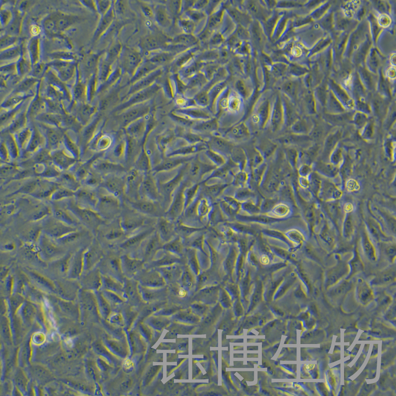 hRMECs（人视网膜微血管内皮细胞）YB-71760HC