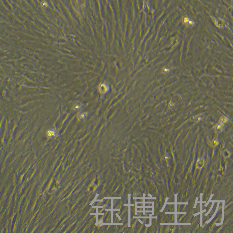 hTERT-HPNE（人正常胰腺导管细胞）YB-71761HC