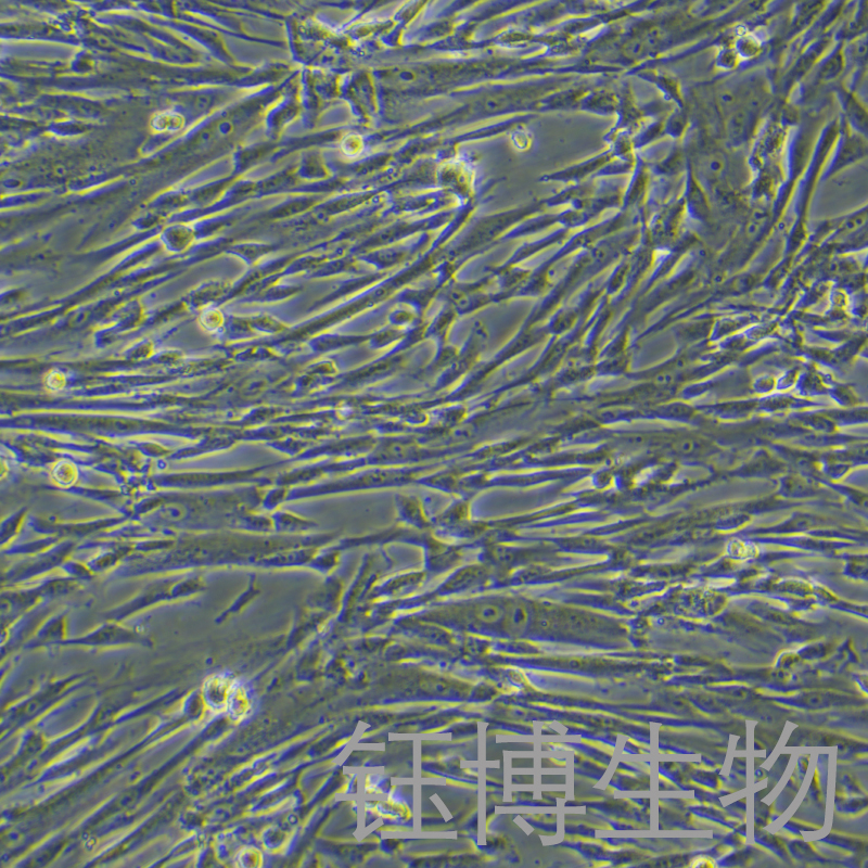 HMSC-bM（人骨髓间充质干细胞）YB-71763HC