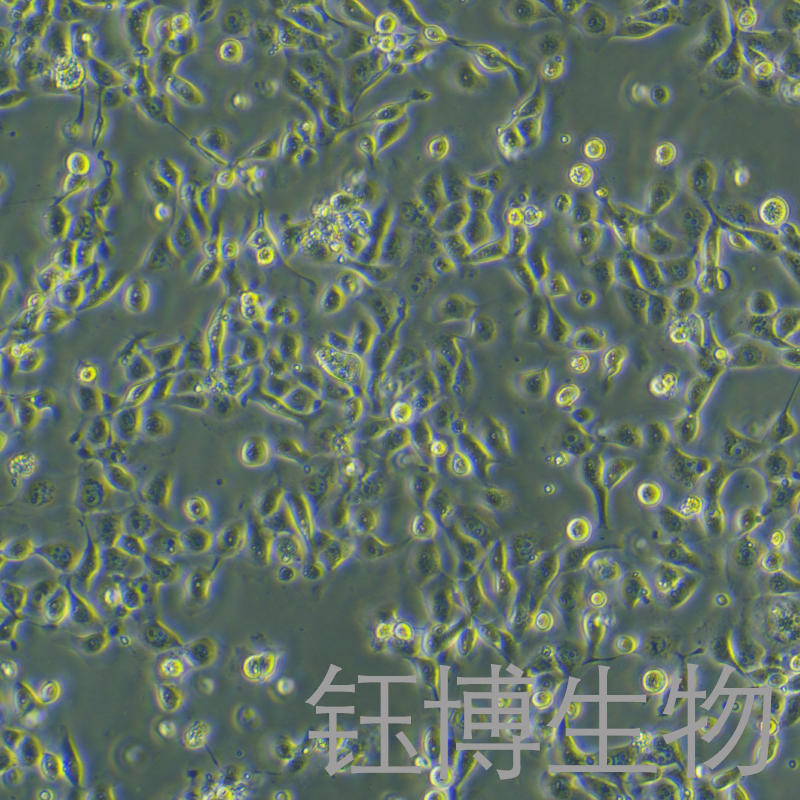 HMRSV5（人腹膜间皮细胞）YB-71767HC