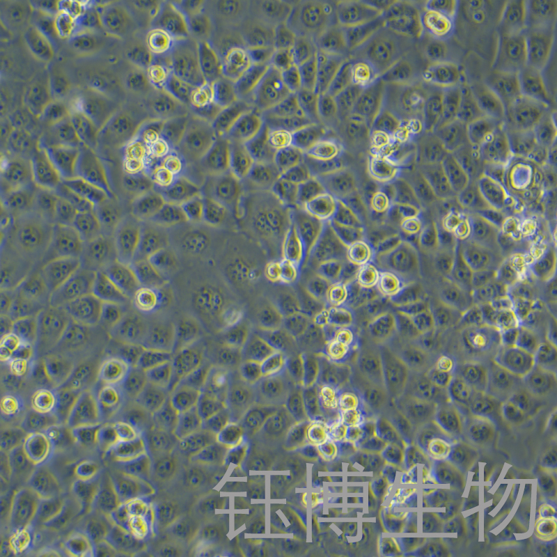 NHEK（正常人表皮角质形成细胞）YB-71765HC