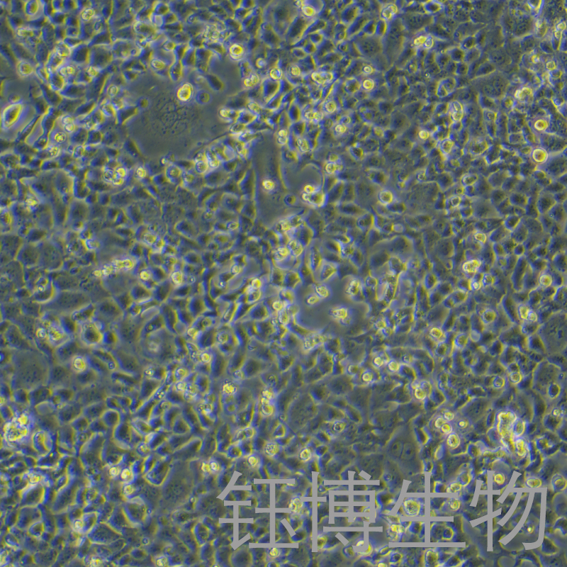 MLE-12（小鼠肺泡上皮细胞）YB-7023MC