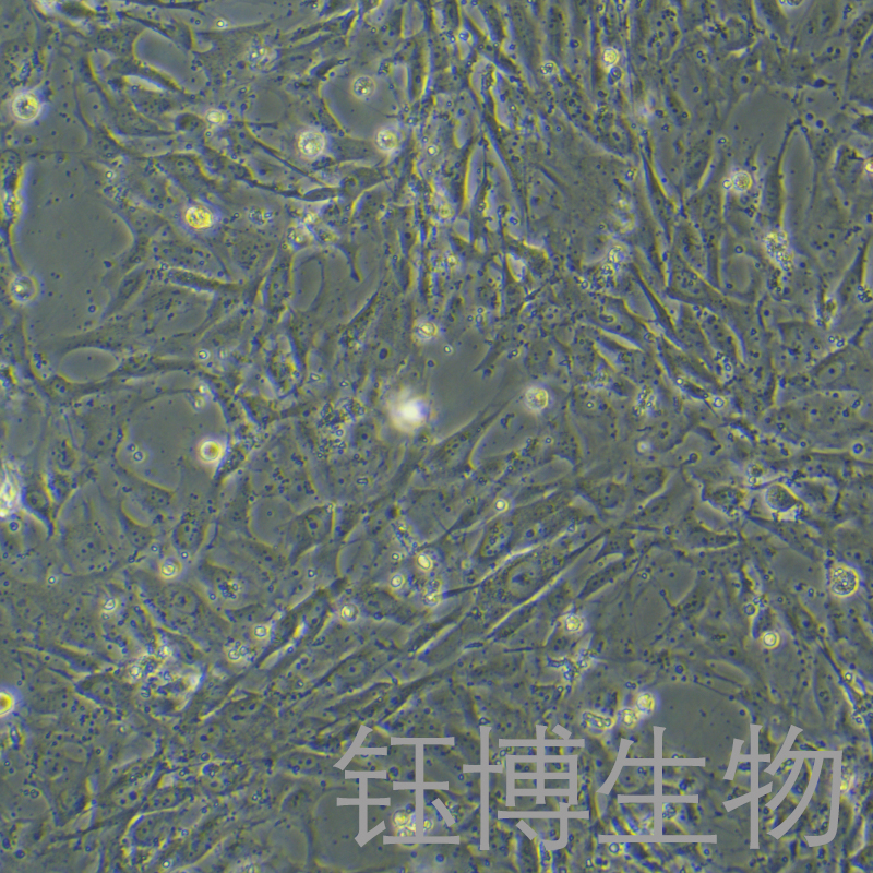 sNF96.2（人雪旺细胞（神经纤维瘤病1型））YB-71770HC