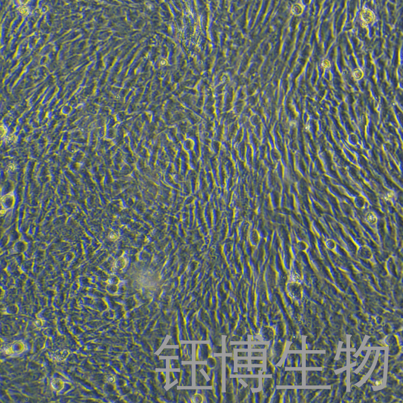 HPASMC（人肺动脉平滑肌细胞）YB-71772HC