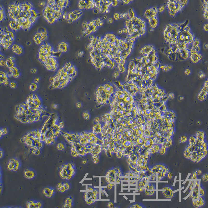 OE19（人食管癌细胞）YB-71773HC