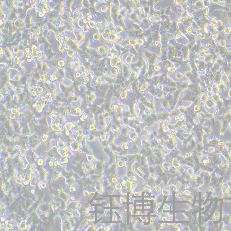 HEPA1-6-LUC（萤火虫荧光素酶标记的小鼠肝癌细胞）YB-7027MCL