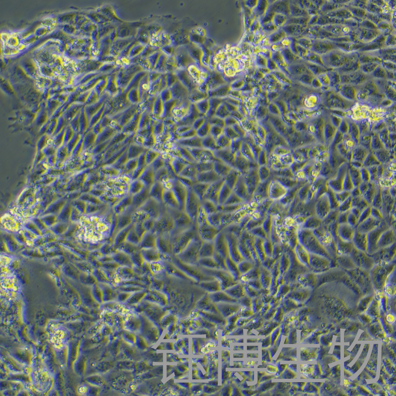 CMT93（小鼠结肠癌细胞）YB-7028MC