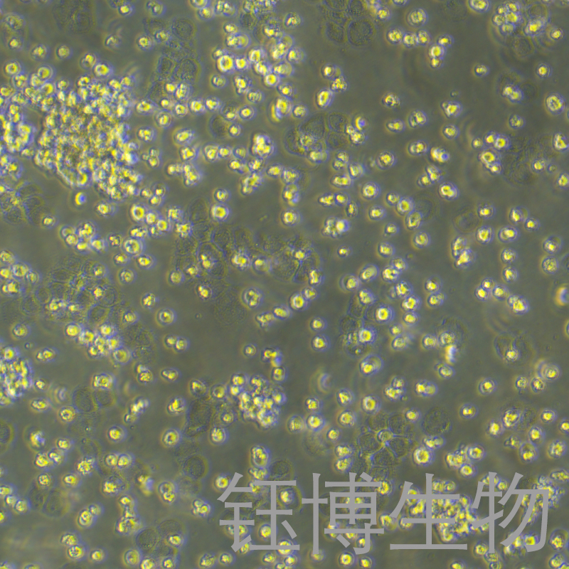 OCI-LY3（人弥漫大B细胞淋巴瘤细胞）YB-71777HC