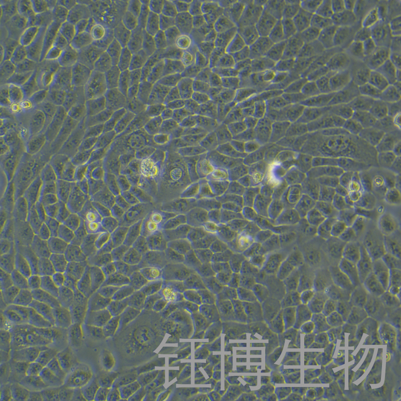 NPC/HK-1（人鼻咽癌细胞）YB-71779HC