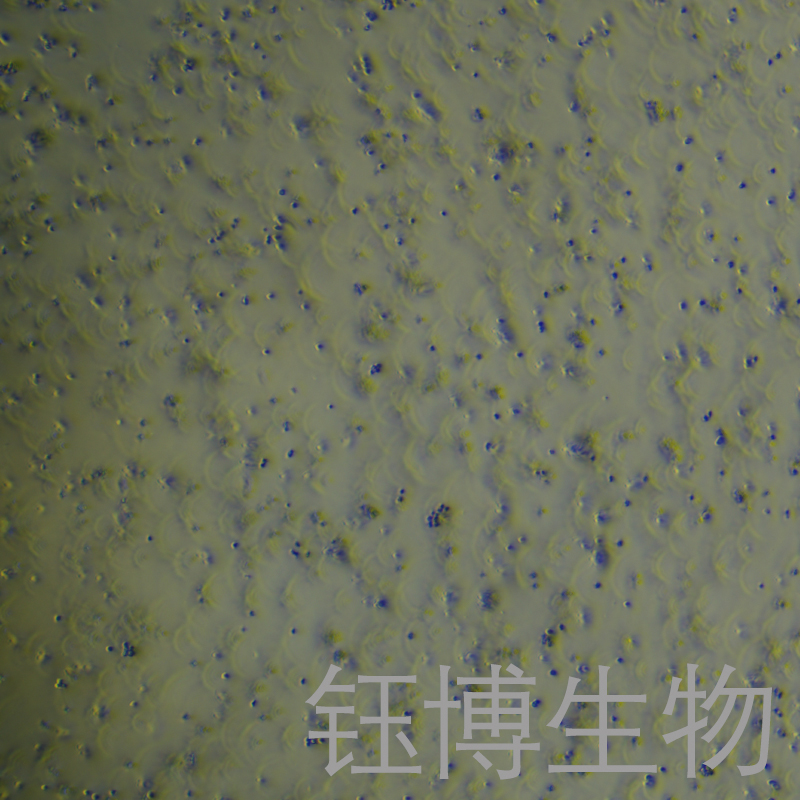 Nalm-6（人B淋巴白血病细胞）YB-71782HC