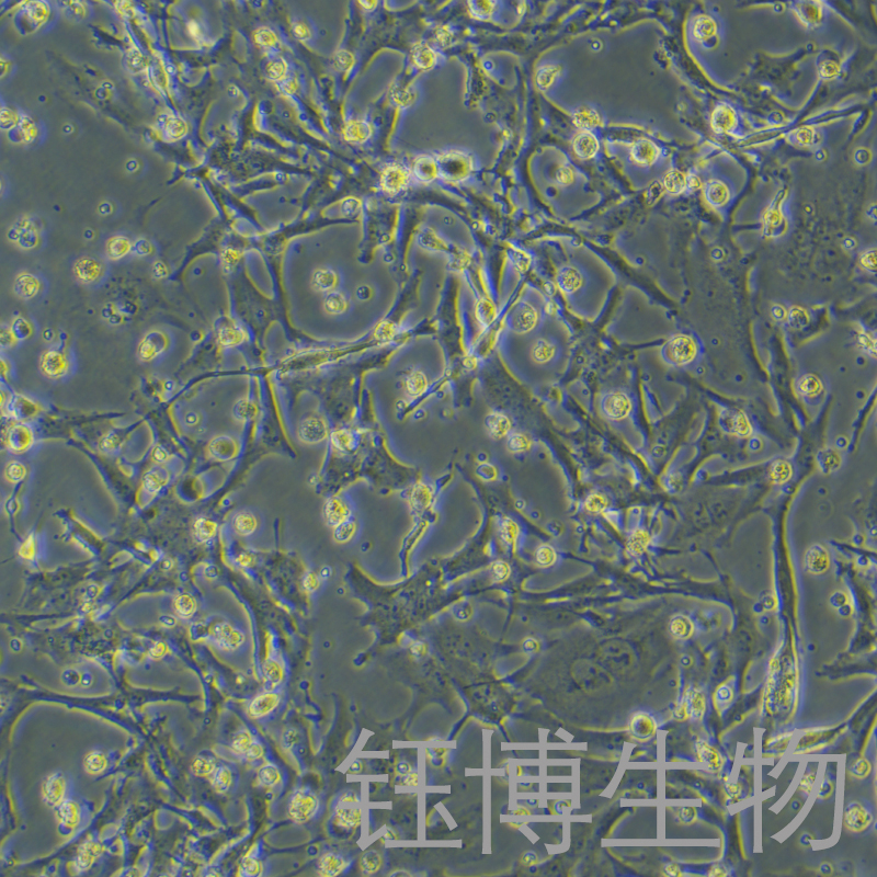 U251/GFP（人神经胶质细胞瘤细胞带绿色荧光）YB-71786HC