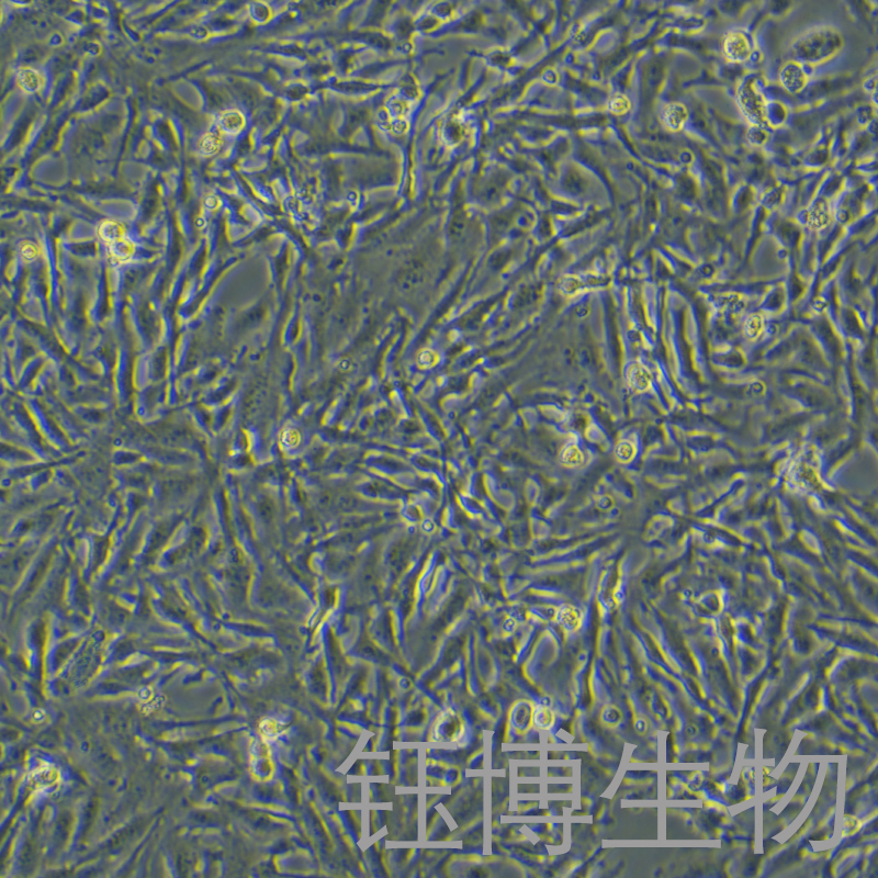 U251/LUC（人神经胶质细胞瘤细胞带荧光素酶）YB-71785HCL