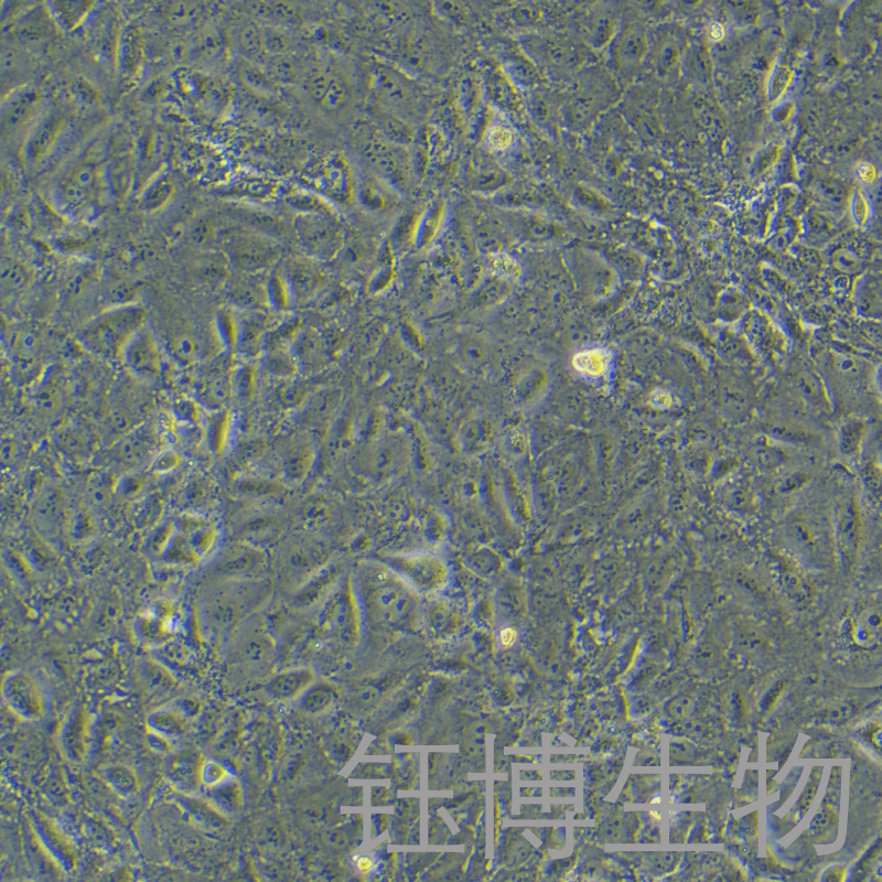 SNU182（人肝癌细胞）YB-71789HC