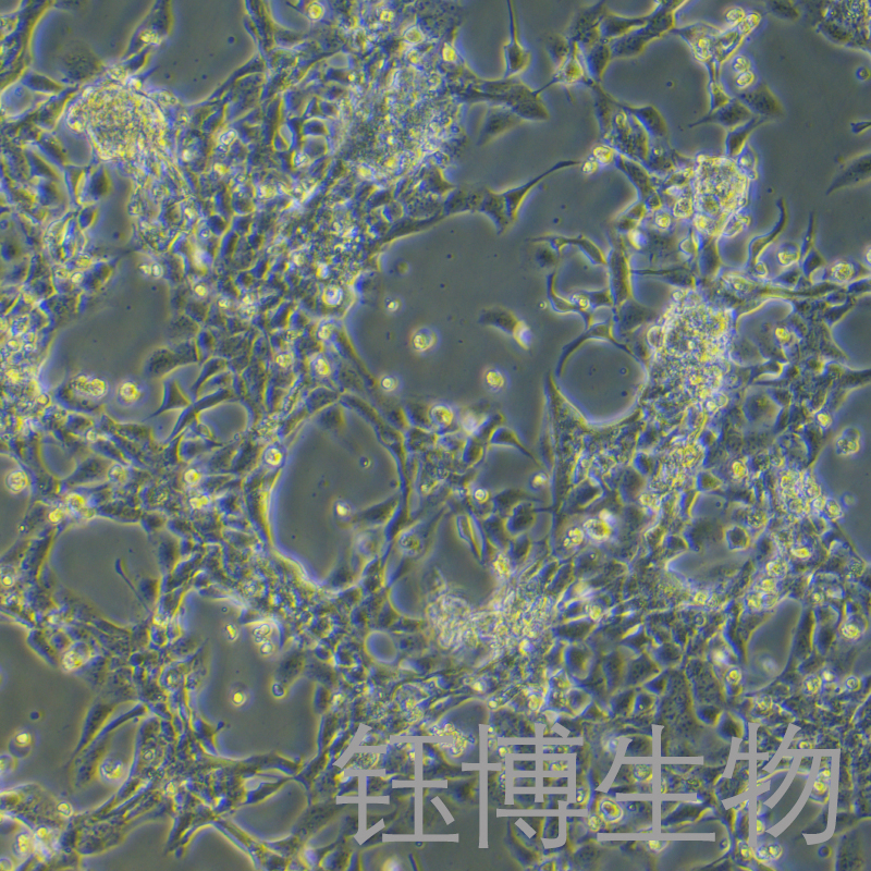 HET-1A（人食管上皮细胞）YB-71790HC