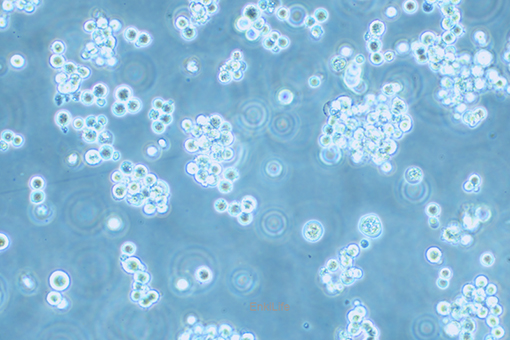 大鼠腹水癌细胞Walker/LLC-WRC 256(种属鉴定) | EnkiLife恩玑生命