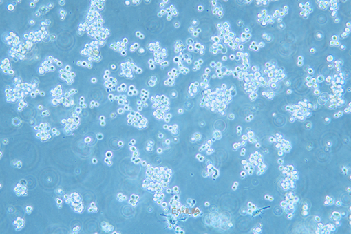 大鼠腹水癌细胞Walker/LLC-WRC 256(种属鉴定) | EnkiLife恩玑生命