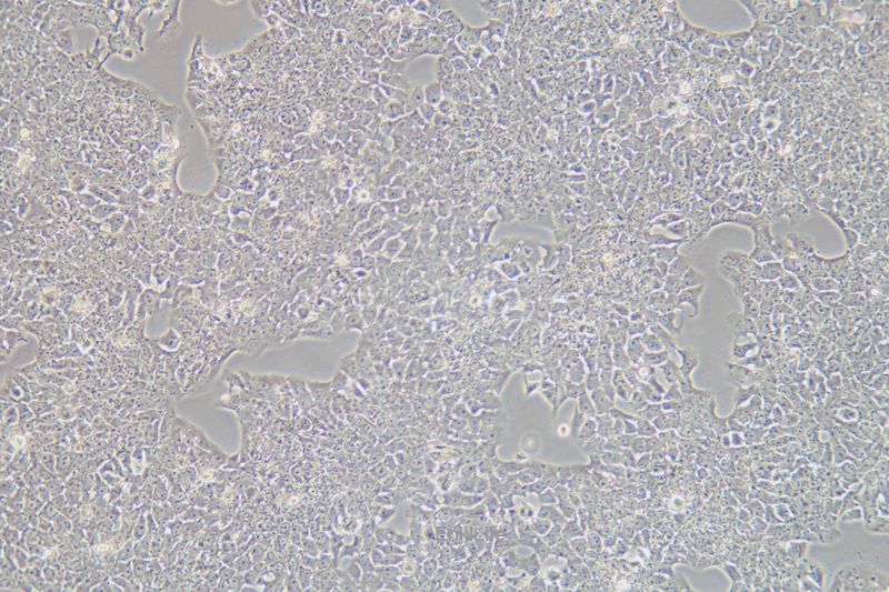 大鼠肝癌细胞CBRH-7919(种属鉴定) | EnkiLife恩玑生命