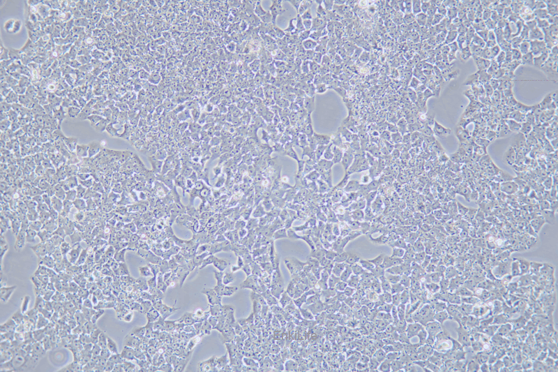 大鼠肝癌细胞CBRH-7919(种属鉴定) | EnkiLife恩玑生命