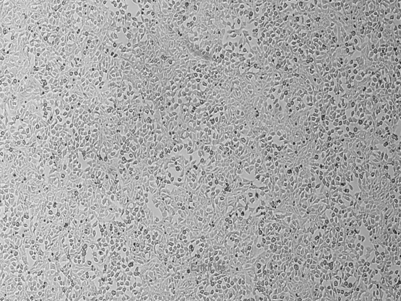 大鼠肝癌细胞RH-35(种属鉴定) | EnkiLife恩玑生命