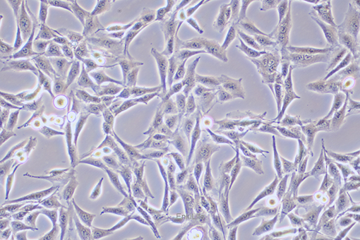 大鼠胶质肉瘤细胞9L/lacZ(种属鉴定) | EnkiLife恩玑生命