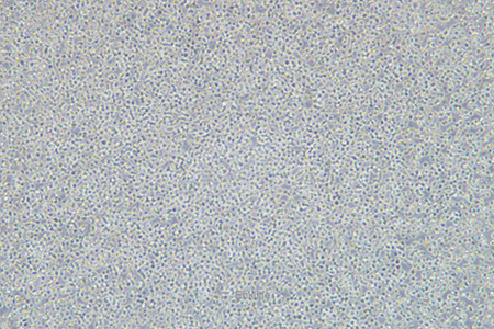 人B淋巴白血病细胞NALM-6(STR鉴定) | EnkiLife恩玑生命