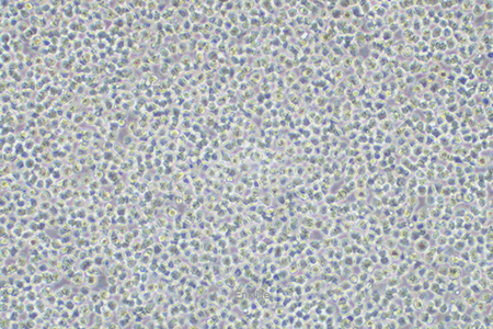 人B淋巴白血病细胞NALM-6(STR鉴定) | EnkiLife恩玑生命