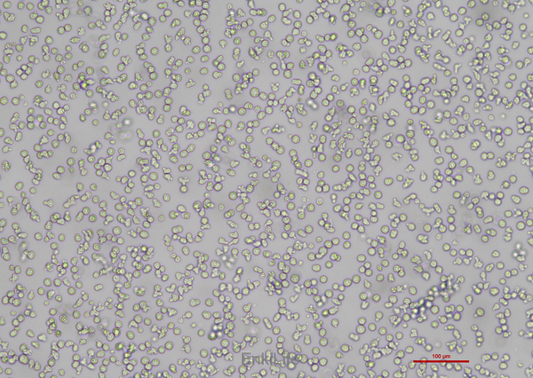 人B淋巴细胞瘤细胞RAMOS(STR鉴定) | EnkiLife恩玑生命