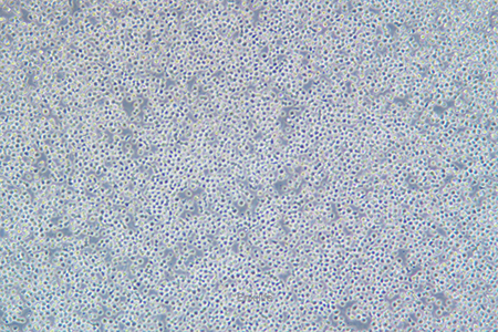 人Ph+急淋白血病细胞SUP-B15(STR鉴定) | EnkiLife恩玑生命