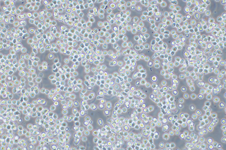 人Ph+急淋白血病细胞SUP-B15(STR鉴定) | EnkiLife恩玑生命