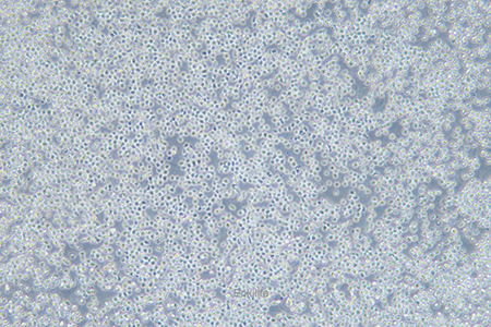 人Ph+急淋白血病细胞SUP-B15(STR鉴定) | EnkiLife恩玑生命