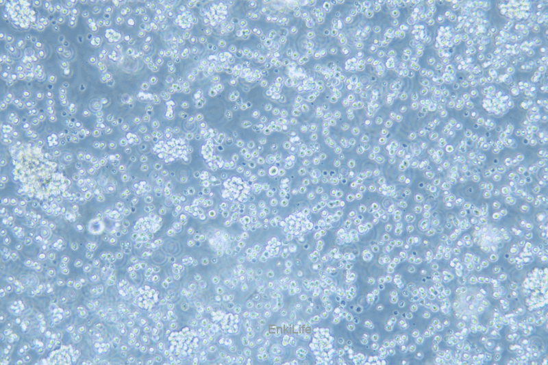 人T淋巴细胞白血病细胞A3(STR鉴定) | EnkiLife恩玑生命