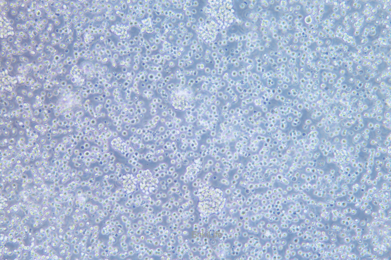 人T淋巴细胞白血病细胞A3(STR鉴定) | EnkiLife恩玑生命