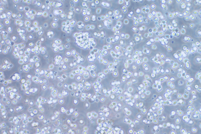 人T淋巴细胞白血病细胞A3(STR鉴定) | EnkiLife恩玑生命