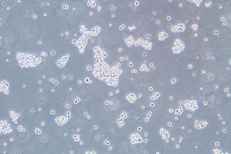 人T淋巴细胞白血病细胞Hut-78(STR鉴定) | EnkiLife恩玑生命