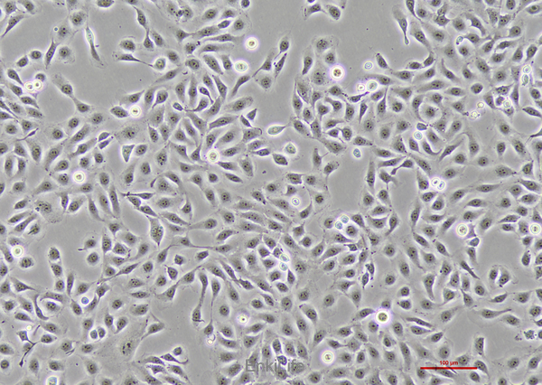 人膀胱癌细胞5637(STR鉴定) | EnkiLife恩玑生命